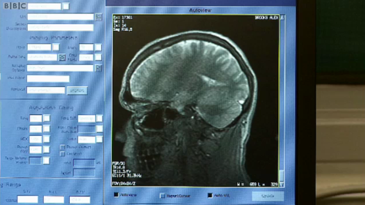 Alex Brooks' MRI Scan